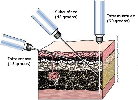 "VIGIAR" Vigilância em Saúde : Curiosidade: Injeção, agulhas? Qual usar 