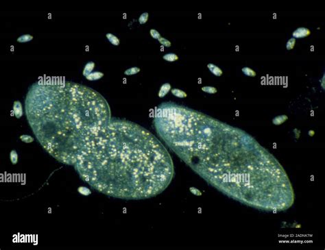 Licht Schliffbild der von Süßwasser ciliate Paramecium sp Protozoen