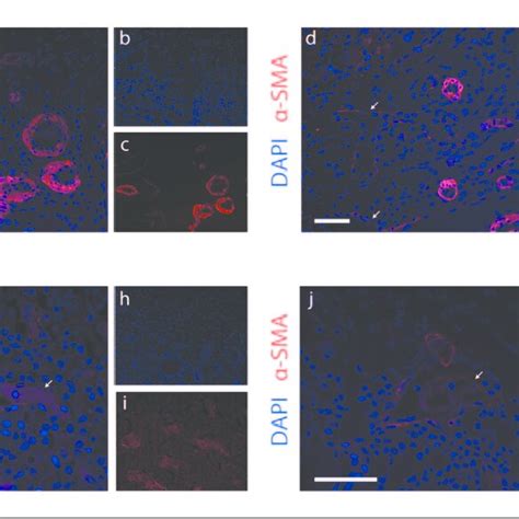 Vegf 165 Overexpression Induces The Formation Of Enlarged Vessels