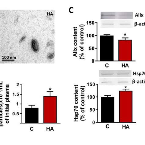 Characterization of extracellular vesicles isolated from plasma of ... 