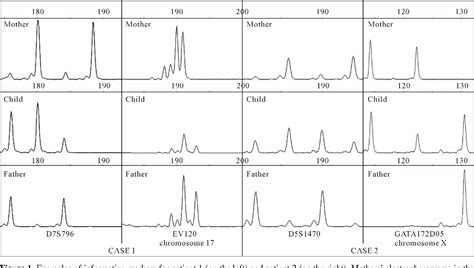 Figure 1 from Mechanism of origin in two cases of chimerism | Semantic ...