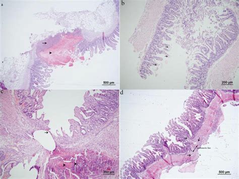 Histological Appearance Of The Ileal Anastomosis Under HE Staining In