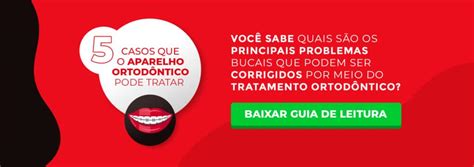 Dicas Sobre Como Cuidar Do Aparelho Ortod Ntico