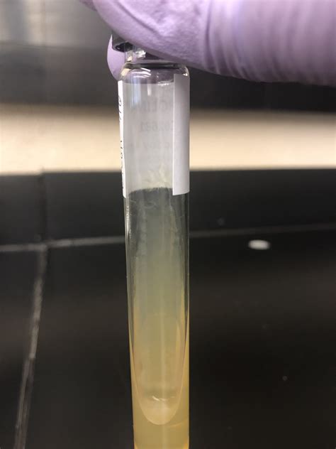 STREAK PLATE – Hands On Microbiology