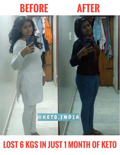 Amazing Keto Journey Of Romi Keto India Transformation Stories