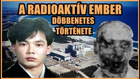 A RADIOAKTÍV EMBER DÖBBENETES TÖRTÉNETE A világ legbrutálabb 211