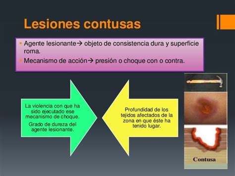 Lesiones Contusas