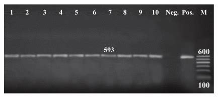 Pcr Amplification Of The Blactx Gene At Bp Lane Showed Ve