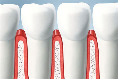 Sanguinamento Delle Gengive Le Possibili Cause E Il Trattamento