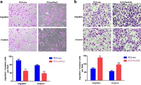 Elevated Expression Of Par Promotes Prostate Cancer Metastasis By