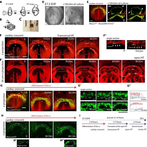 Live Imaging Of Heart Tube Development In Mouse Reveals Alternating