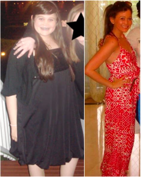 My Weight Loss Before After