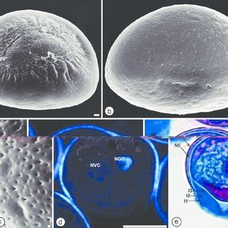 Microsporogenesis And Microgametogenesis In Fertile Anthers Of