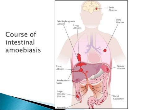 Intestinal And Extraintestinal Amoebiasis