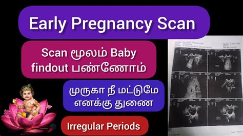 Irregular Periods Pregnant ஆக முடியுமா Pregnancy எத்தனை Week Early Pregnancy Scan Youtube