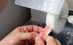 Denture Repairs Relines Aesthetic Dental Denture Clinic