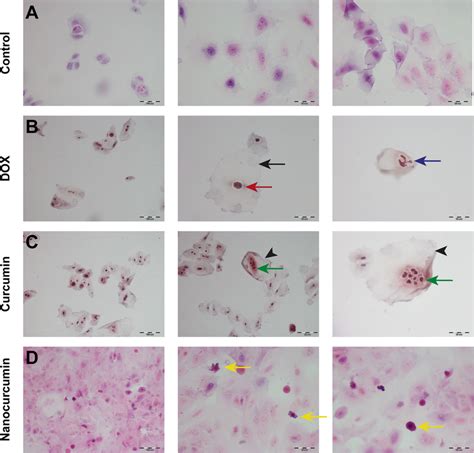 A Light Microscope Photomicrograph Of Hande Stained Cytological Smears