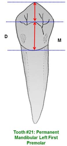 Tooth Morphology Lecture 6 Flashcards Quizlet