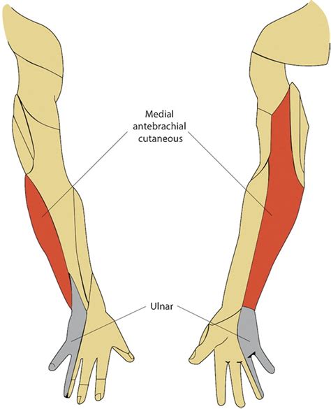 Differentiating C T Radiculopathy From Ulnar Neuropathy A Survey Of