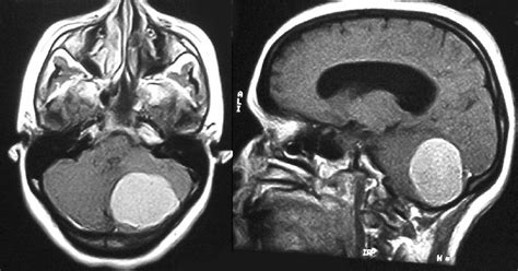 Imagenología De La Cabeza Y El Cerebro Concise Medical Knowledge