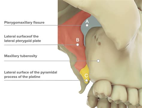 Easier pterygoid area management with ROOTT P | TRATE