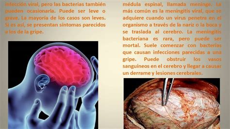 Cinco Enfermedades Del Sistema Nervioso