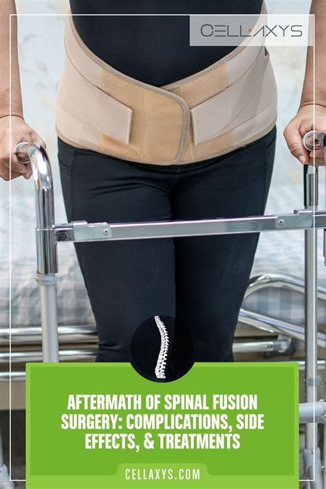 Aftermath of Spinal Fusion Surgery: Complications and Treatments