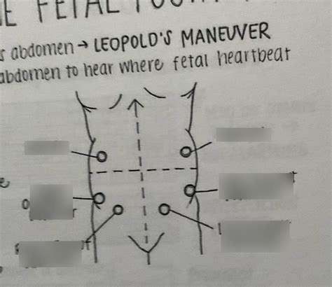 How to determine fetal position Diagram | Quizlet