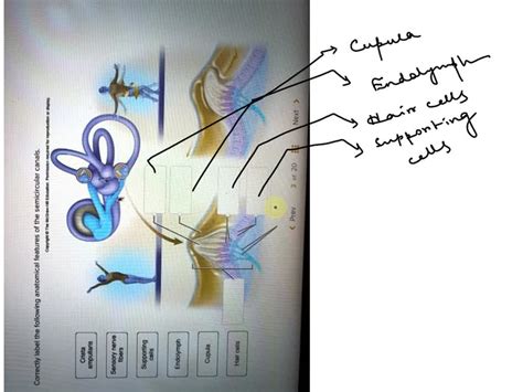 Solved Label The Structures Of The Hair Follicle Hair Papilla External