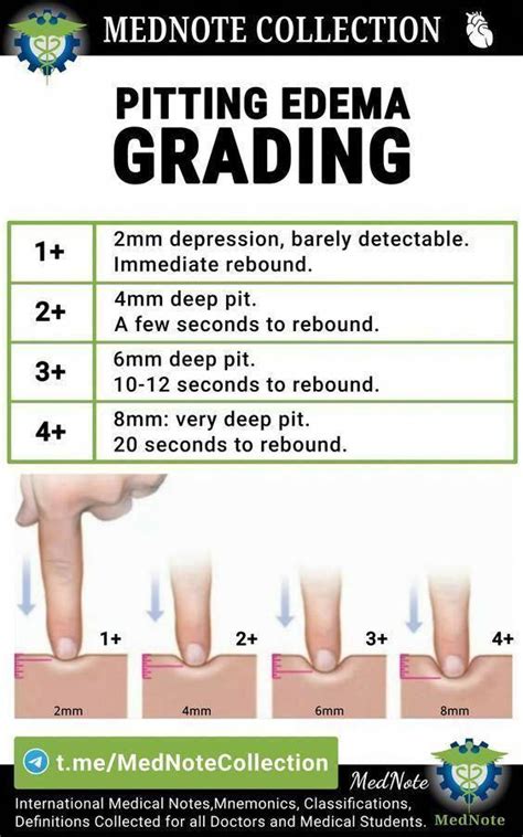 Best 12 Pitting Edema Grading Medicalschool Resources Medicalstudent