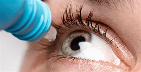 Cornea Treatment - Dr. Vivek Jain's - AIY Vision Centre