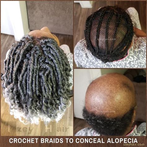 Alopecia Crochet Box Braids In 2024