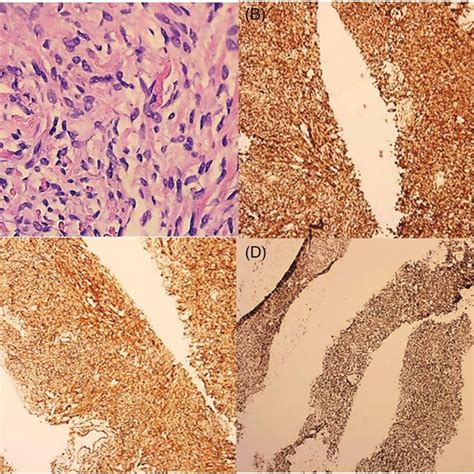 A Microscopy Of Tissue Specimen Stained With Hematoxylin And Eosin