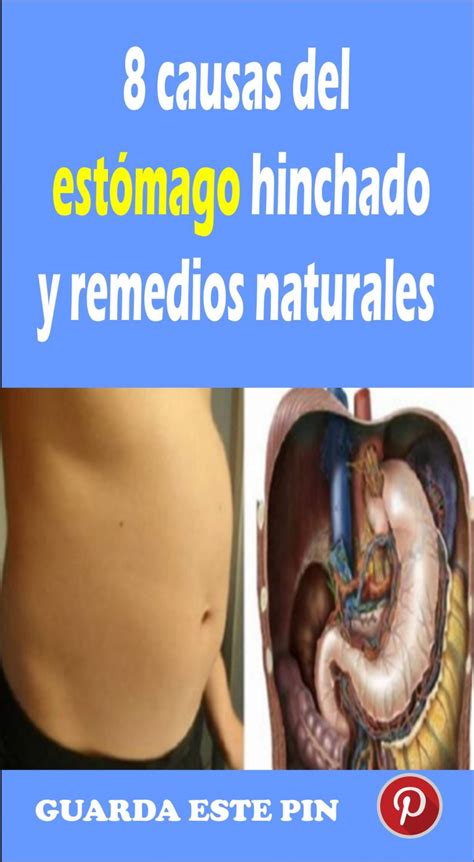 Causas Del Est Mago Hinchado Y Remedios Naturales Tu Consulta