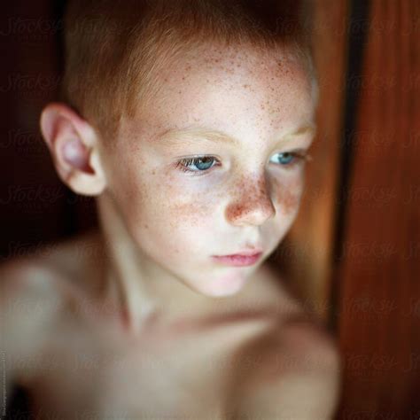 Pin On Freckles Are Beautiful