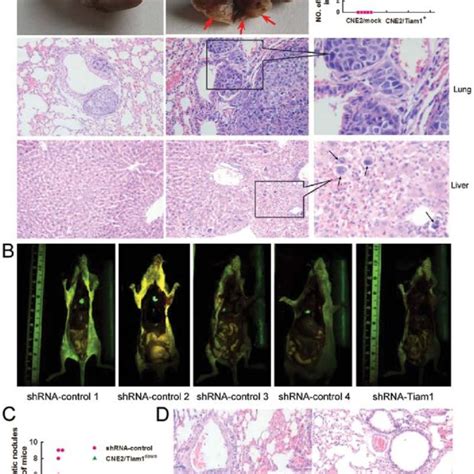 Alteration Of Tiam1 Expression Affects The Adhesion Invasion And