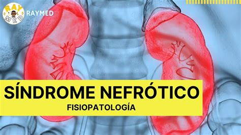 Fisiopatolog A Del S Ndrome Nefr Tico En Minutos Youtube