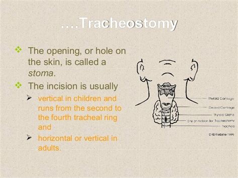 Surgical Airway Procedures