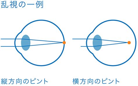 目の豆知識 老眼とはどんな症状 ビジョンライフサロン