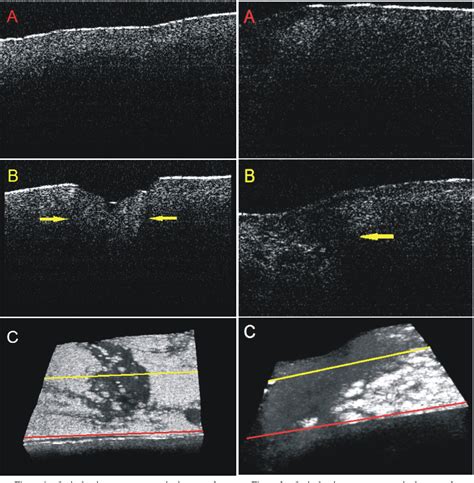 Figure 1 From Optical Coherence Tomography As A Promising Imaging Tool