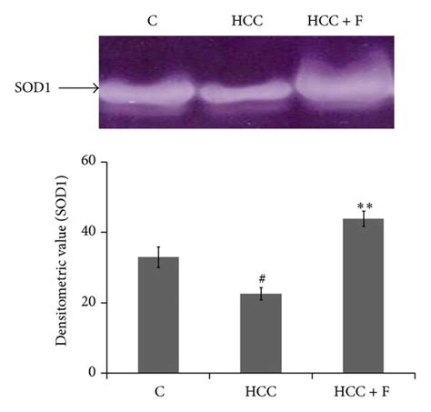 Effect Of Fisetin On Expression A And Activity Profile B Of SOD1 In