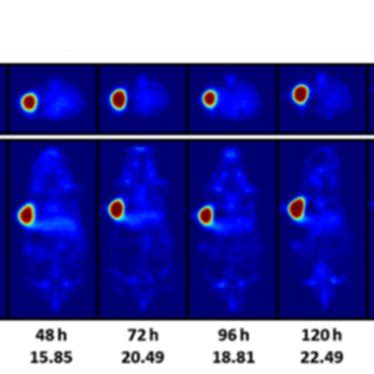 PET Images Highlight The Pharmacologic Properties Of 89 Zr 5B1 In Human