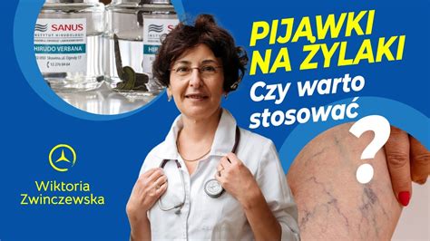 Pijawki Na Żylaki Czy Warto Stosować Pijawki Na Żylaki YouTube