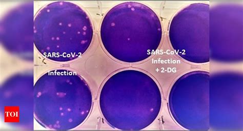 2 DG Drug Initially Developed For Cancer Treatment Lures Coronavirus