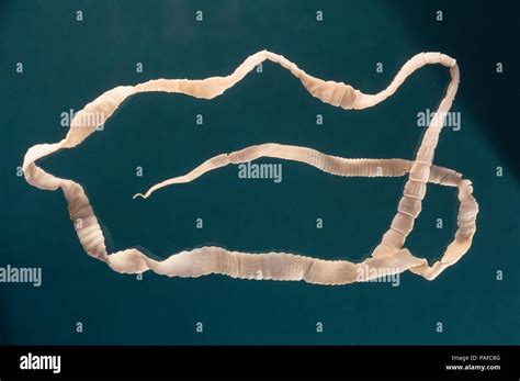 Tapeworm In Human Body