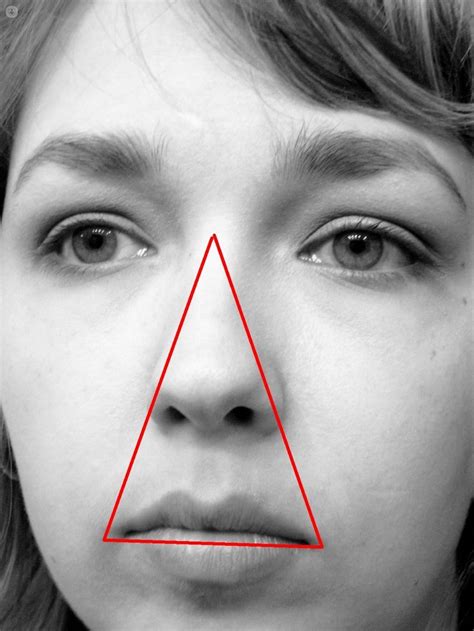 Sinusitis Conoce Esta Inflamaci N De Las Cavidades Faciales