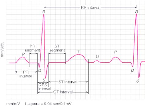 Ecg Parameters Of Normal Ecg Signal Download Scientific Diagram