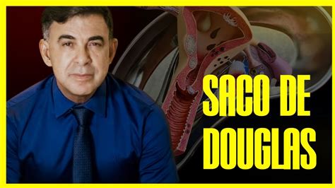 Saco De Douglas Conhe A As Causas Do Rompimento E A Sua Import Ncia