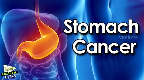 Stomach Cancer Symptoms Causes Risk Factors And Treatment Health