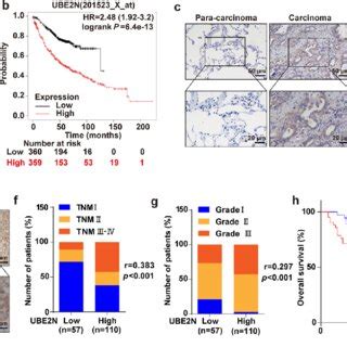 A High Level Of Ube N Expression In Luad Is Associated With A Poor